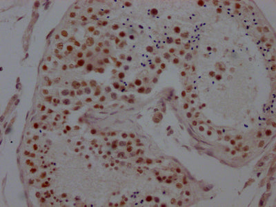 KDM1A Antibody