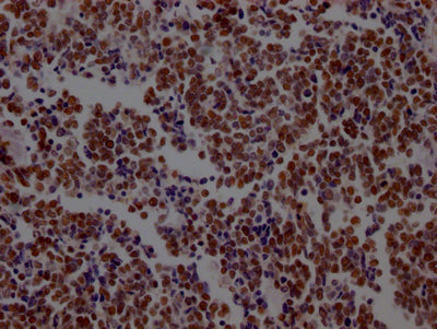 KDM1A Antibody