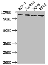 KDM1A Recombinant Monoclonal Antibody
