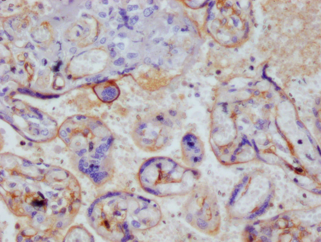 THBD Recombinant Monoclonal Antibody