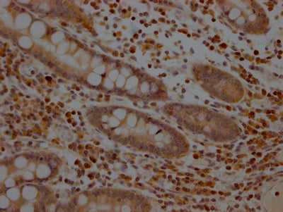 MAP2K1 Antibody