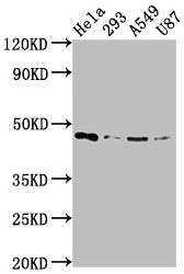 MAP2K1 Recombinant Monoclonal Antibody