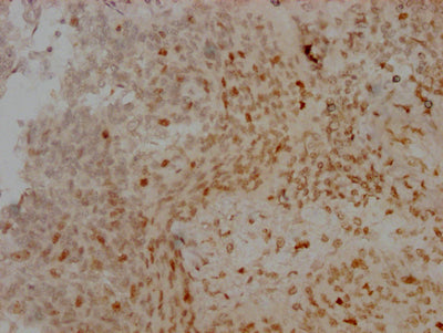 AURKB Antibody