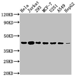 AURKB Antibody