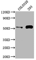 TP53 Recombinant Monoclonal Antibody