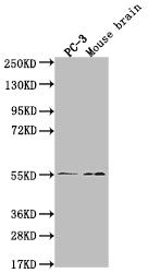 MAPK10 Recombinant Monoclonal Antibody