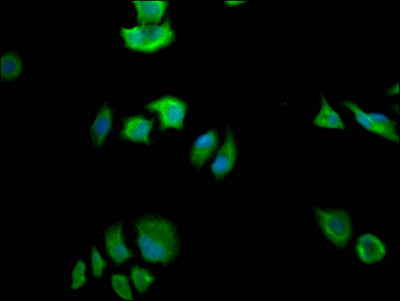 FASN Recombinant Monoclonal Antibody