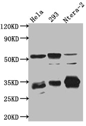 CASP3 Recombinant Monoclonal Antibody