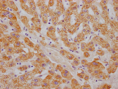 ABAT Recombinant Monoclonal Antibody