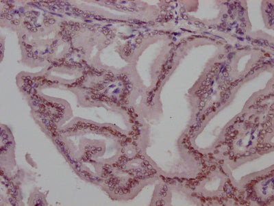 AR Recombinant Monoclonal Antibody