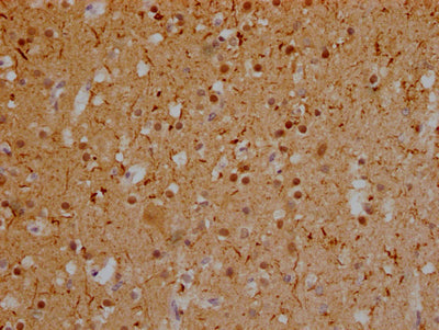 MAPT Antibody