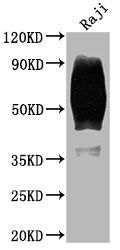 CD80 Recombinant Monoclonal Antibody