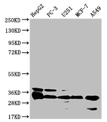 TMEM192 Recombinant Monoclonal Antibody