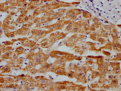 MAOA Recombinant Monoclonal Antibody