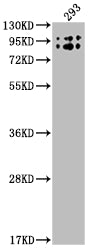 BCHE Recombinant Monoclonal Antibody