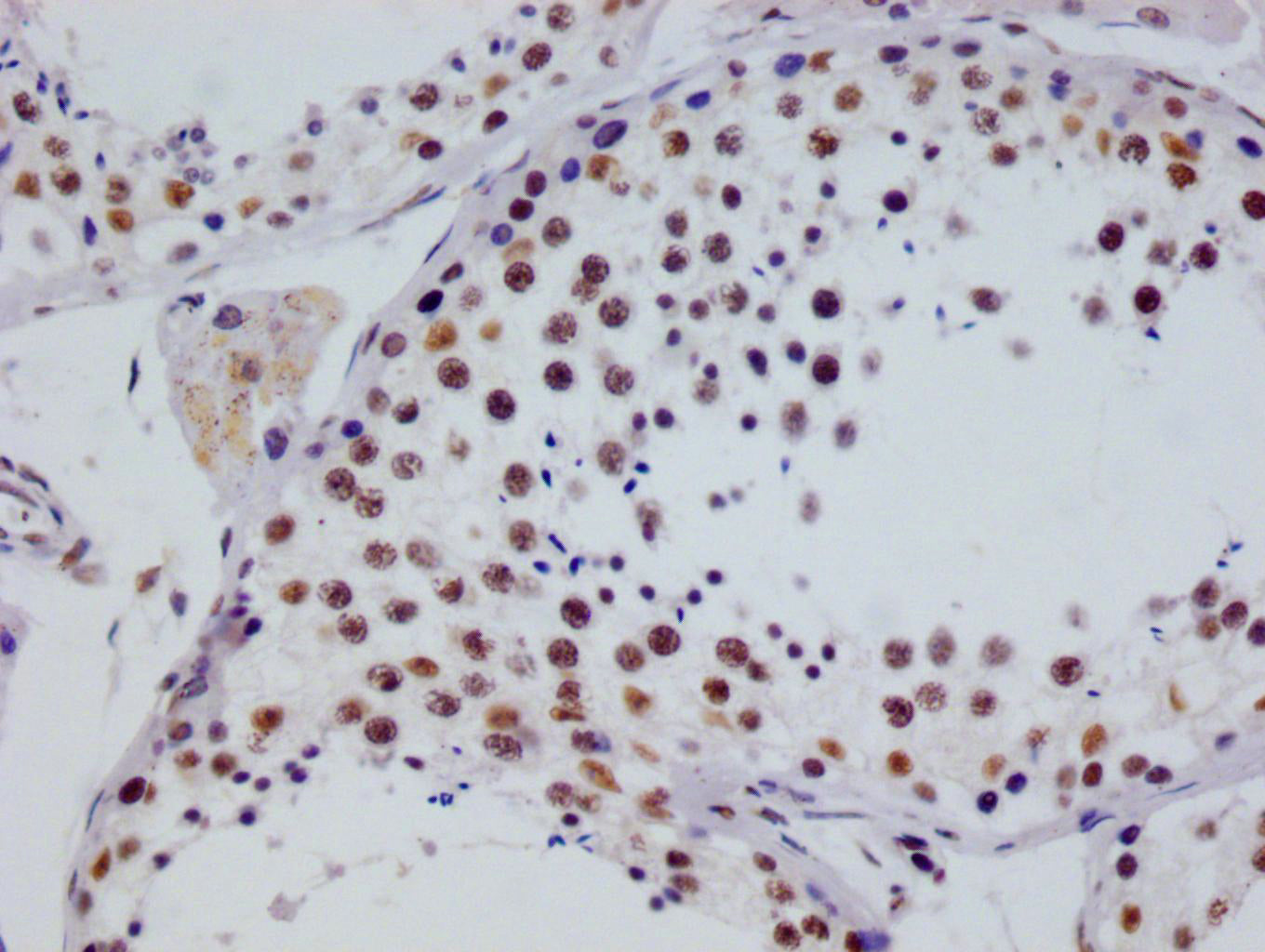 RGS6 Recombinant Monoclonal Antibody