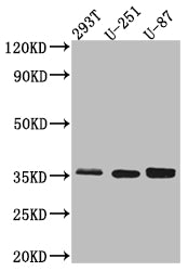 SPP1 Recombinant Monoclonal Antibody