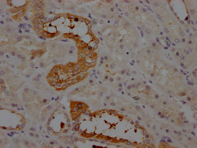 AGT Antibody