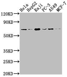 ALAS1 Recombinant Monoclonal Antibody