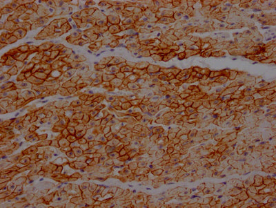 DMD Recombinant Monoclonal Antibody