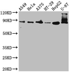 FURIN Recombinant Monoclonal Antibody