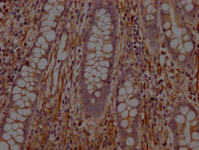 PTPN1 Antibody
