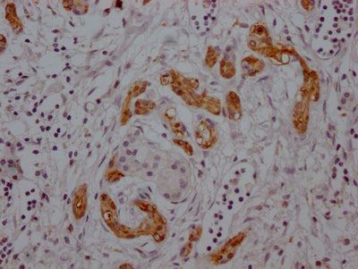 MDK Recombinant Monoclonal Antibody