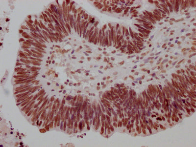 HSF1 Recombinant Monoclonal Antibody
