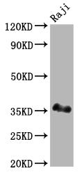 POU2AF1 Recombinant Monoclonal Antibody