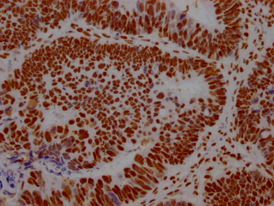 ILF3 Recombinant Monoclonal Antibody
