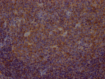 METAP2 Recombinant Monoclonal Antibody