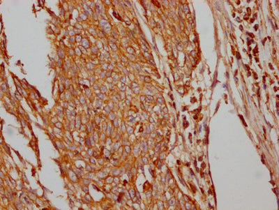 SLC2A1 Recombinant Monoclonal Antibody