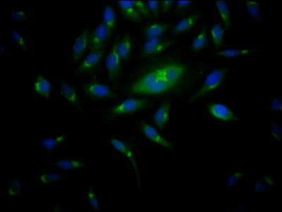 RPS6KB1 Recombinant Monoclonal Antibody