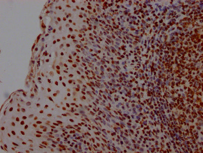Hmgb1 Antibody