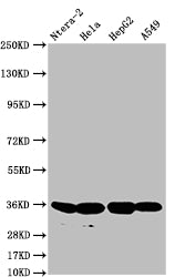 FGF19 Recombinant Monoclonal Antibody
