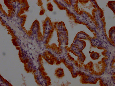 KLK3 Recombinant Monoclonal Antibody