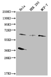 SMAD4 Recombinant Monoclonal Antibody