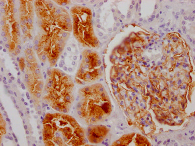 ENPEP Recombinant Monoclonal Antibody