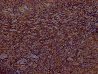 BTK Recombinant Monoclonal Antibody