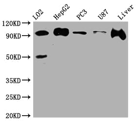 PDCD6IP Recombinant Monoclonal Antibody