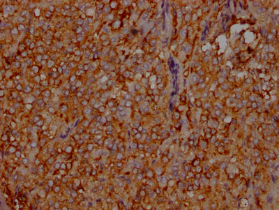 LDLR Antibody