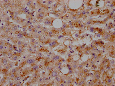 LDLR Antibody