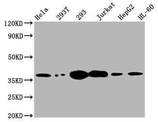 TYMS Recombinant Monoclonal Antibody
