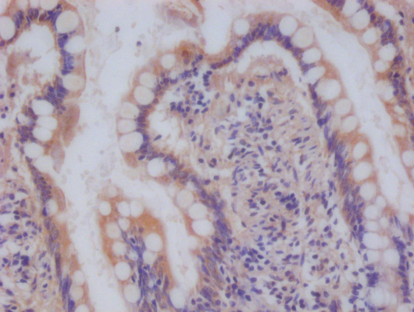 NDUFS4 Recombinant Monoclonal Antibody