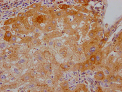 F10 Recombinant Monoclonal Antibody