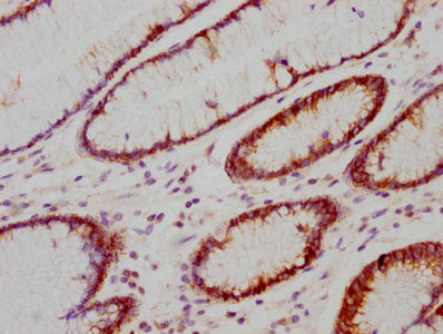 CA9 Recombinant Monoclonal Antibody