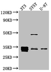 CCND1 Recombinant Monoclonal Antibody
