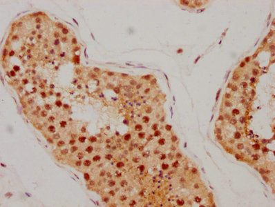 ATM Antibody