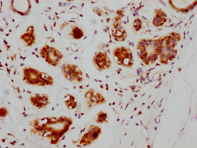 ATM Antibody