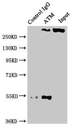 ATM Antibody